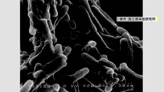 提供：国立感染症研究所