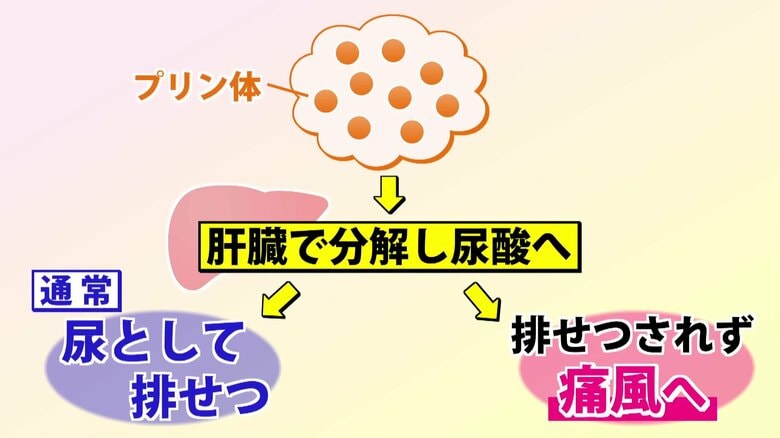 プリン体が上手く排出されないと痛風に