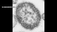 「はしか」感染拡大　東京・新宿区の小学校で学年閉鎖に　2026年の都内感染者は180人で過去10年で最多に