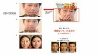 「シワ、たるみが3日で消えた」「初回限定1980円」など違法表示　美容クリーム販売会社に業務停止命令　消費者庁