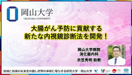 【岡山大学】大腸がん予防に貢献する新たな内視鏡診断法を開発!