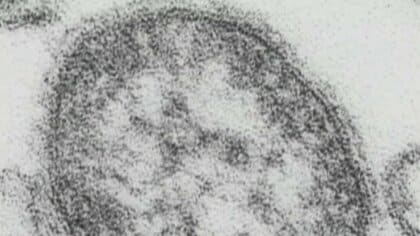 インドネシア渡航歴の20代男性が「はしか」感染 　極めて感染力の強い病気「免疫なければほぼ100％発症」　さらに患者発生の可能性があり県が注意喚起　富山