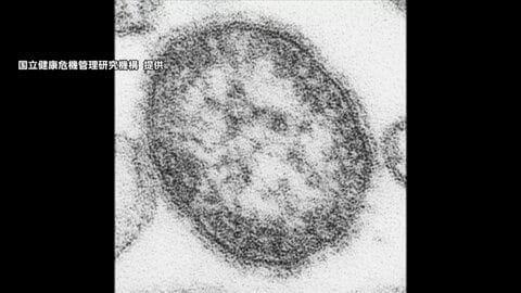 「はしか」感染拡大　東京・新宿区の小学校で学年閉鎖に　2026年の都内感染者は180人で過去10年で最多に