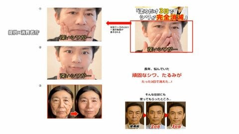 「シワ、たるみが3日で消えた」「初回限定1980円」など違法表示　美容クリーム販売会社に業務停止命令　消費者庁