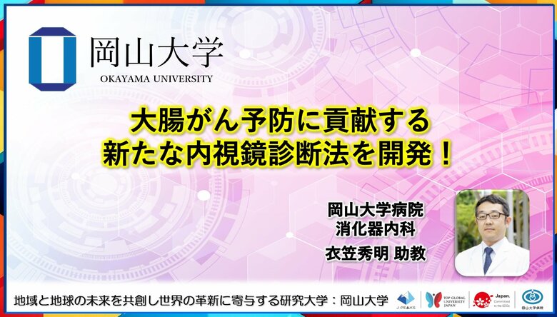 【岡山大学】大腸がん予防に貢献する新たな内視鏡診断法を開発!