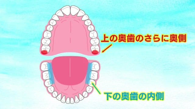 磨き残しが多いところ