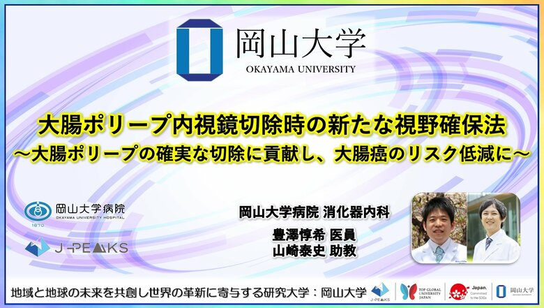 【岡山大学】大腸ポリープ内視鏡切除時の新たな視野確保法～大腸ポリープの確実な切除に貢献し、大腸癌のリスク低減に～