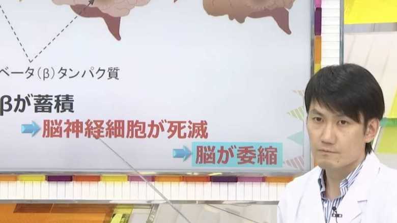 認知症治療に新たな光明! ポイントは「新薬」&「既存薬の再開発」