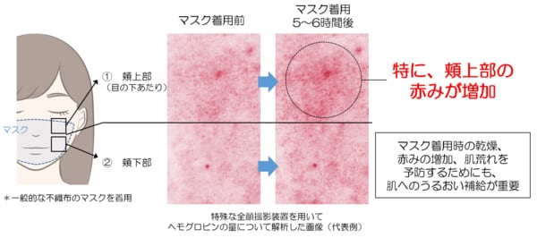 新しい生活様式では 肌へのうるおい補給が重要 最近の肌状態に関するアンケート調査から見えてきた肌荒れリスク