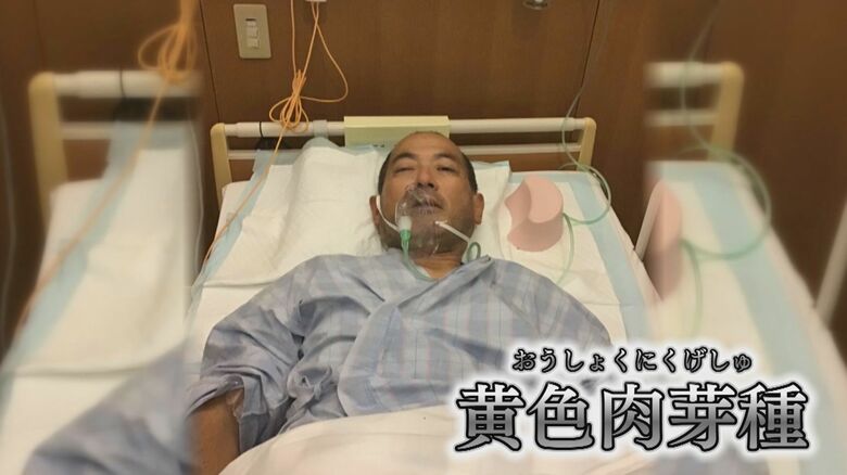 全国でもわずか数例の難病