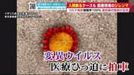 入院断るケースも…最前線の医師が証言「自分たちが十分に応えられていないジレンマある」