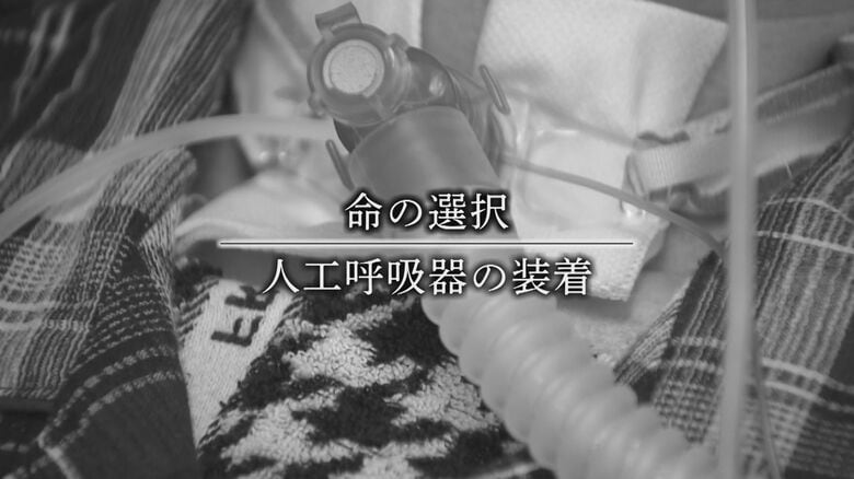 人工呼吸器装着か否か…結論が迫られる日々
