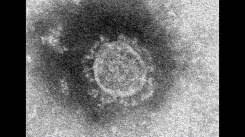 提供：国立感染症研究所