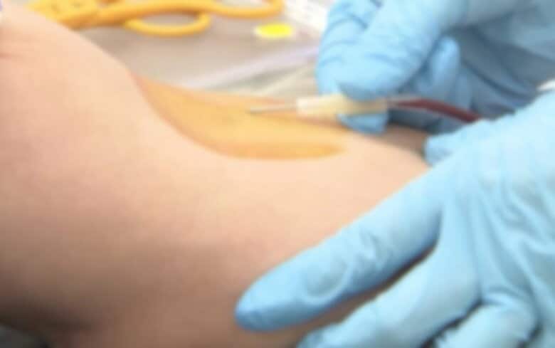 【献血会場で事故】使用済み針を別の人に刺す…廃棄すべき採血バッグをそのままにし「誤穿刺」か…すぐに気づいて血液検査→異常なしも「献血の信頼を損なう事態」北海道赤十字センター〈札幌市〉｜FNNプライムオンライン