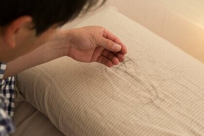 クーリング・オフできないことが理由？「薄毛治療」のトラブル相談が増加…対処法を都の消費生活総合センターに聞いた