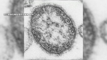 「はしか」感染者数去年の4倍超　前週から32人増え139人　海外からウイルス持ち込まれ国内で感染か