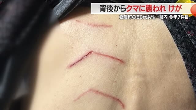 ＜クマ出没＞「やられるかと思った」背中につめ跡　ウシのエサ荒らされる・人的被害7件目　山形・飯豊町