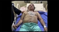 しゃっくり続き...腸閉塞 大統領入院 3年前 暴漢に刺された箇所が...