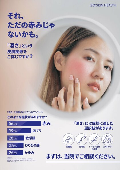 ゼオスキンヘルス、酒さ・赤ら顔に関する消費者調査を実施。自己流ケアでは適切な対応ができておらず、酒さ・赤ら顔の症状をさらに悪化させている可能性が示唆された。