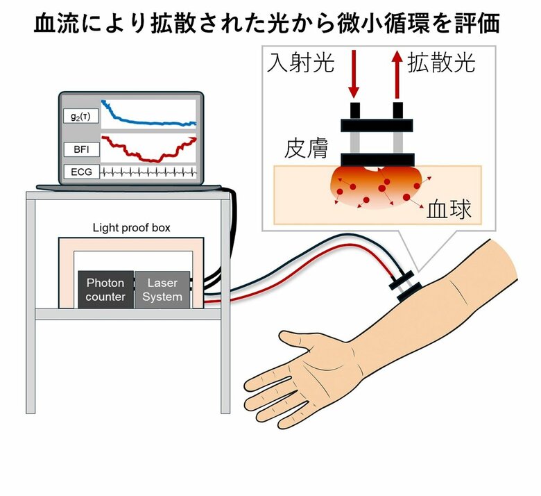 光学的血流計測による出血性ショックの微小循環変化を可視化~早期微小循環不全の診断と治療判断への貢献に期待~