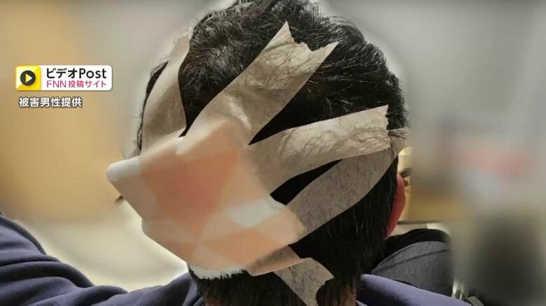 【何が】「固いもの当たって血まみれに」“石のようなもの”が男性の後頭部直撃…マンションから投げられたか　全治2カ月の大けがで入院　殺人未遂も視野に捜査　熊本市｜FNNプライムオンライン