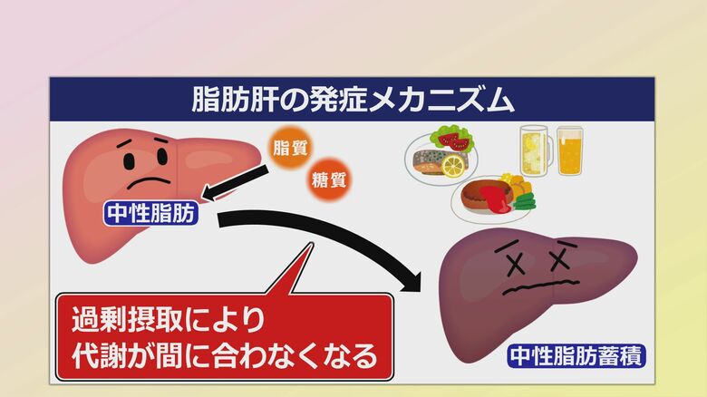 脂肪肝になるメカニズム
