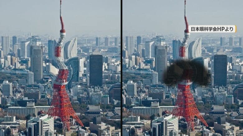 加齢黄斑変性の患者の視野（イメージ）