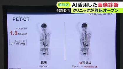 AI活用した最新機器で検査の負担減へ『東名古屋画像診断クリニック』10月に昭和区で移転オープン