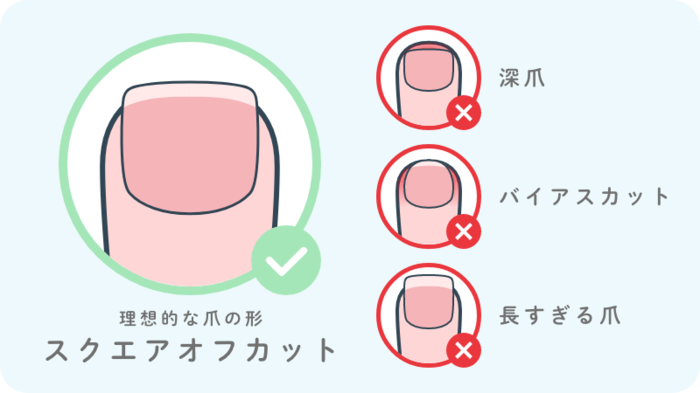 理想的な爪の形はこれ!