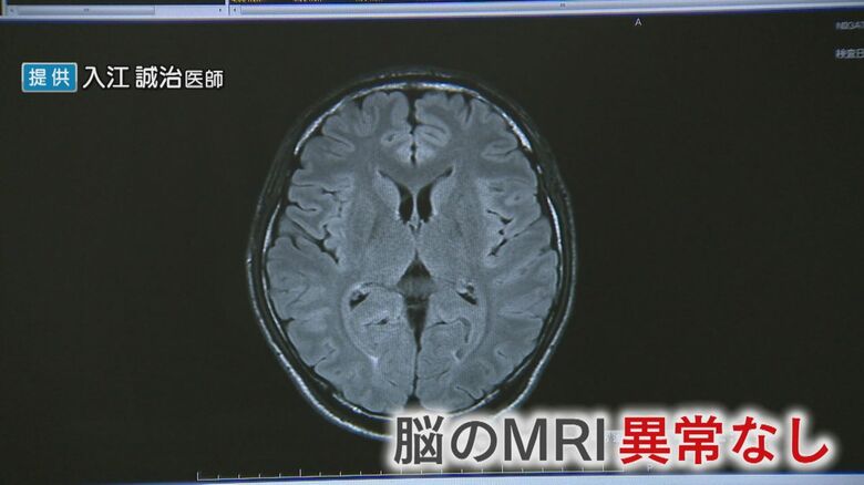 検査では異常みられず