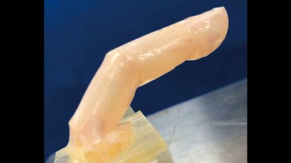 「傷が治る」「皺（しわ）もできる」 生きた”皮膚”持つロボット開発成功 世界初　東京大学