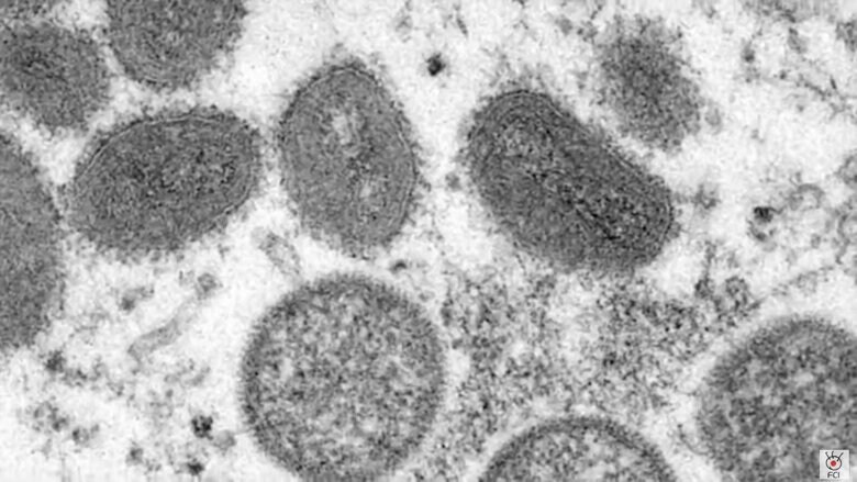 ニューヨーク市で「サル痘」感染拡大　無症状の人からの感染も…ワクチン供給追いつかず｜FNNプライムオンライン