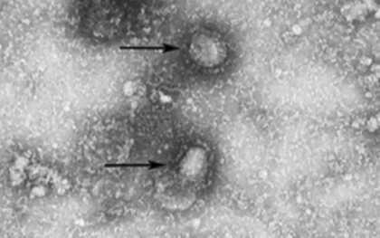 【速報】新型コロナウイルス 重症者が過去最多の1001人 17日連続で前日上回る