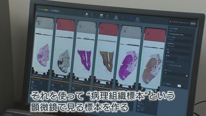 病理組織標本