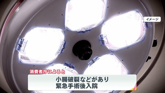 小腸破裂で緊急手術に