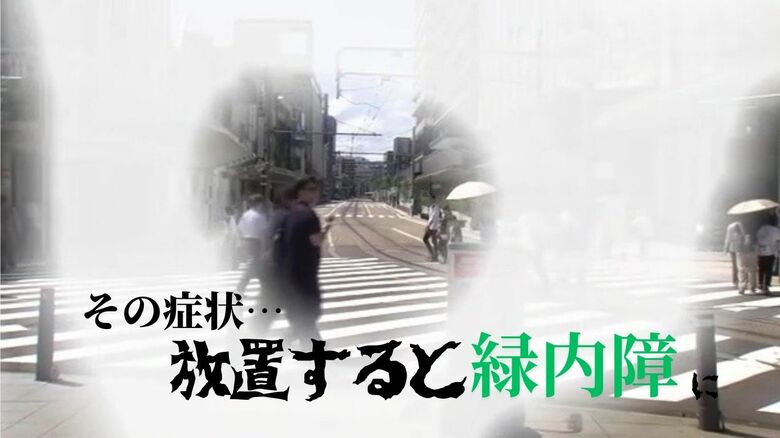 近視なら20代でも要注意…病気の“一歩手前”アイフレイルの症状とは　目が良くても緑内障が進行している場合も｜FNNプライムオンライン