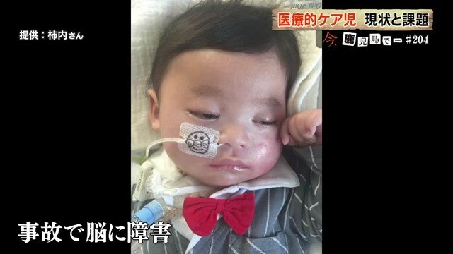 脳に障害を負った瑛斗くん