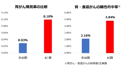 AI支援内視鏡が上部消化管がんの発見率を向上～大規模健診施設における約5万人のデータで実証～