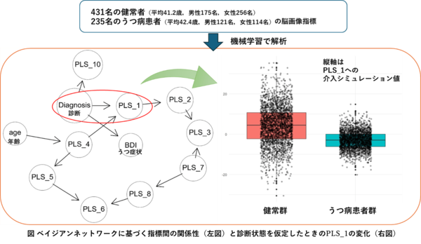 うつ病診断と脳機能結合の潜在的な関係構造が明らかに―機械学習を用