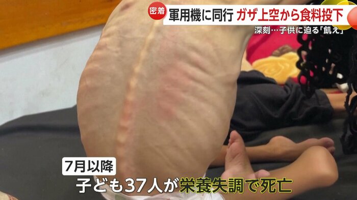 7月以降に子ども37人が栄養失調で死亡したという