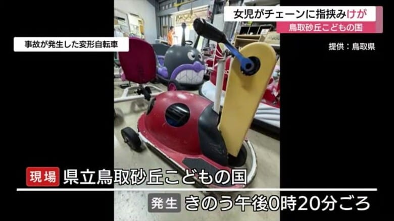「鳥取砂丘こどもの国」で５歳の女児が中指を５ミリ欠損するけが「変形自転車」のチェーンで挟む（鳥取市）｜FNNプライムオンライン
