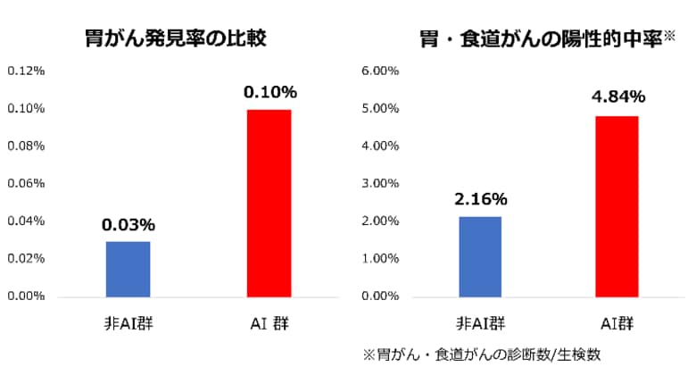 AI支援内視鏡が上部消化管がんの発見率を向上～大規模健診施設における約5万人のデータで実証～