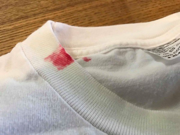 日焼け止めクリームの成分と反応して変色（提供：神崎健輔さん）