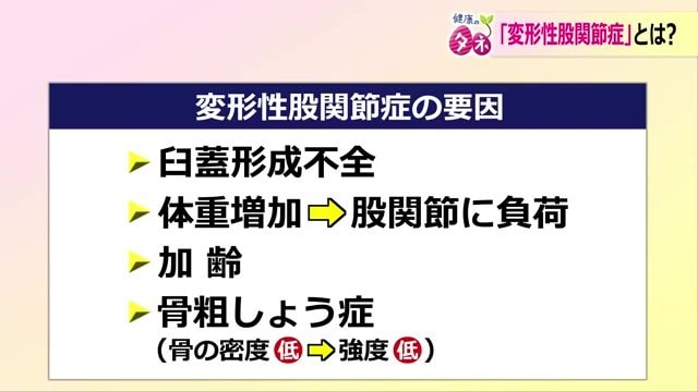 変形性股関節症の要因