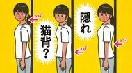 姿勢はいいはずなのに肩がこる…実は「隠れ猫背」かも？整形外科医が教える今すぐできるセルフチェックと“改善体操”