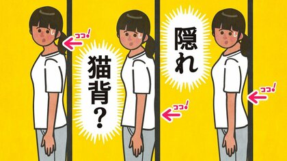 姿勢はいいはずなのに肩がこる…実は「隠れ猫背」かも？整形外科医が教える今すぐできるセルフチェックと“改善体操”｜FNNプライムオンライン