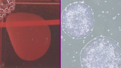 iPS細胞由来2製品を初の実用化へ　心不全とパーキンソン病治療で