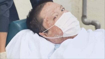 【独自】全身やけど痕の京アニ事件青葉容疑者　医療チーム「真相解明のために治療」