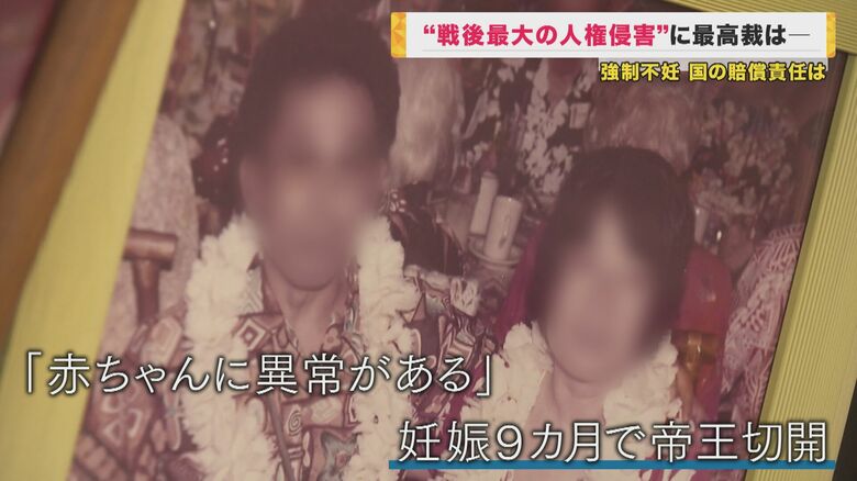 妊娠9か月で帝王切開　同時に不妊手術