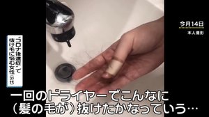 ハリウッド女優も告白 コロナ後遺症なのか?新型コロナから回復した後、抜け毛に悩まされる女性続出